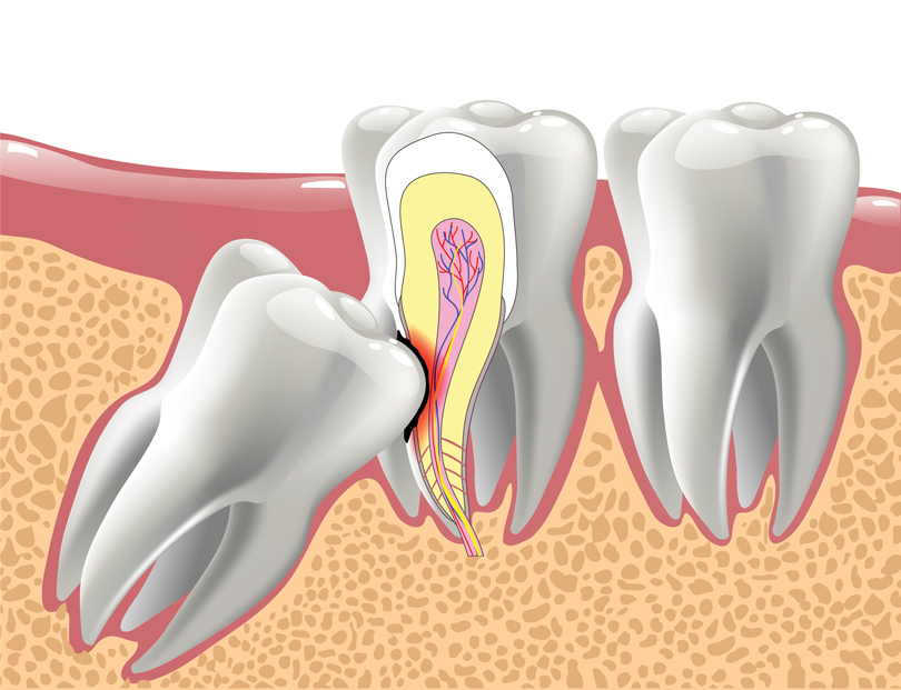 blog - Olive Tree Dental